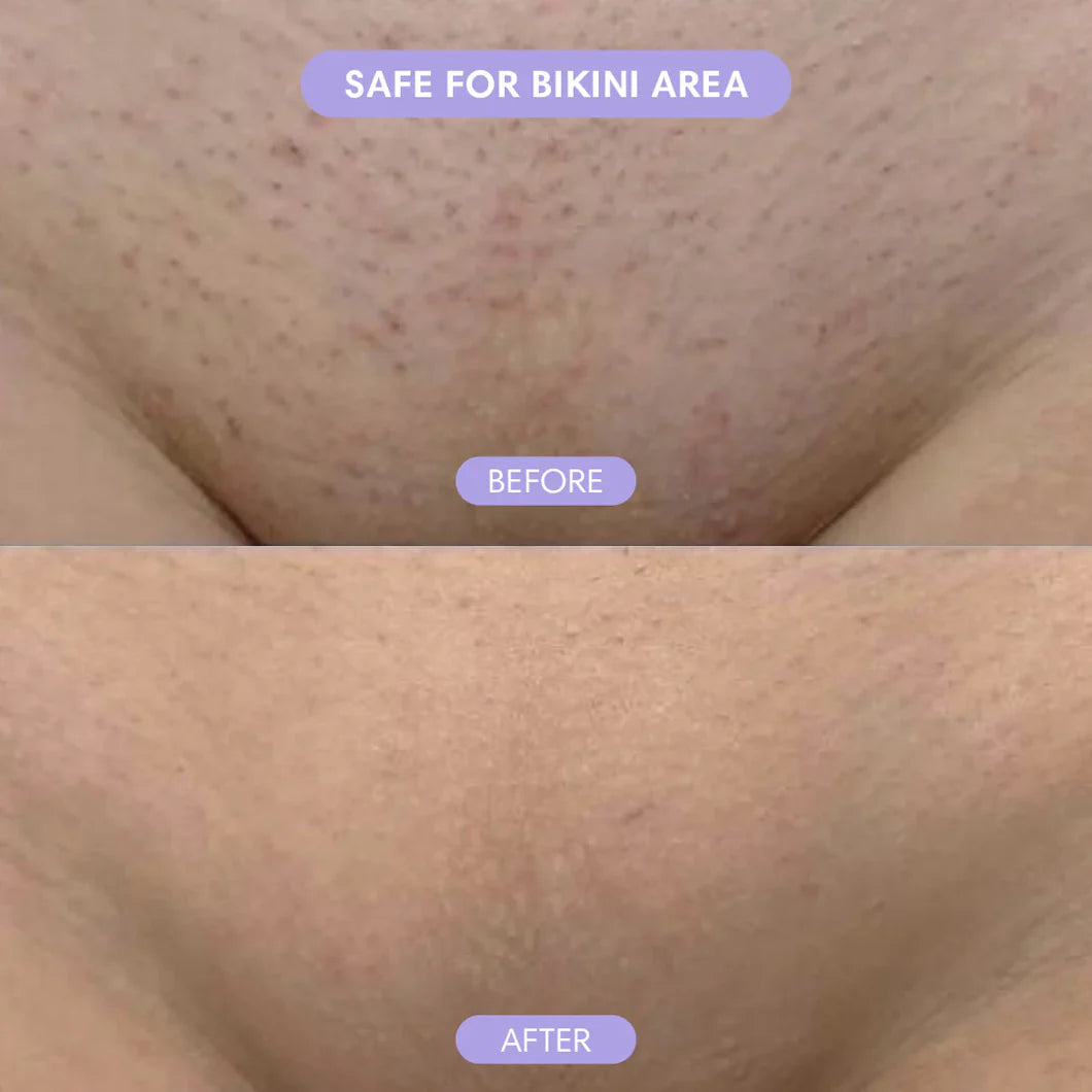 Smoothé — Body Hair Removal Spray