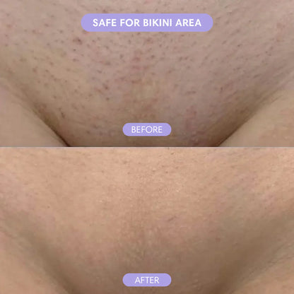 Smoothé — Body Hair Removal Spray