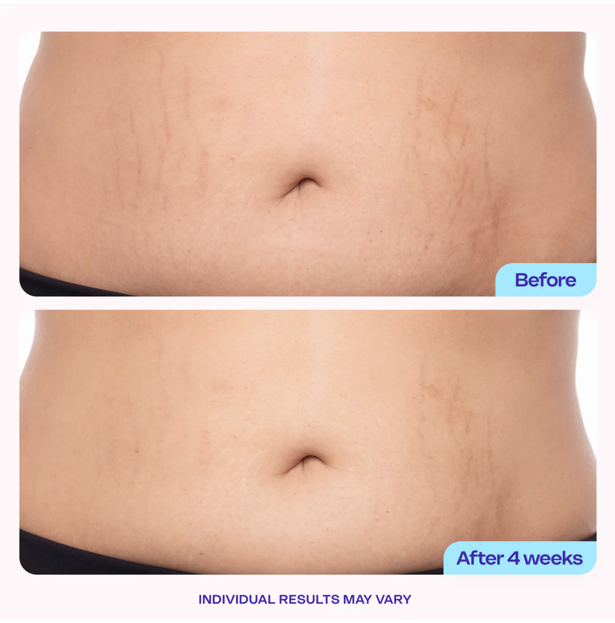 Your belly has been ignored long enough. Give it this.