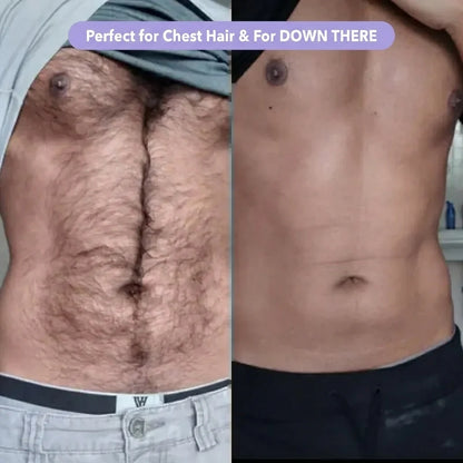 Smoothé — Body Hair Removal Spray